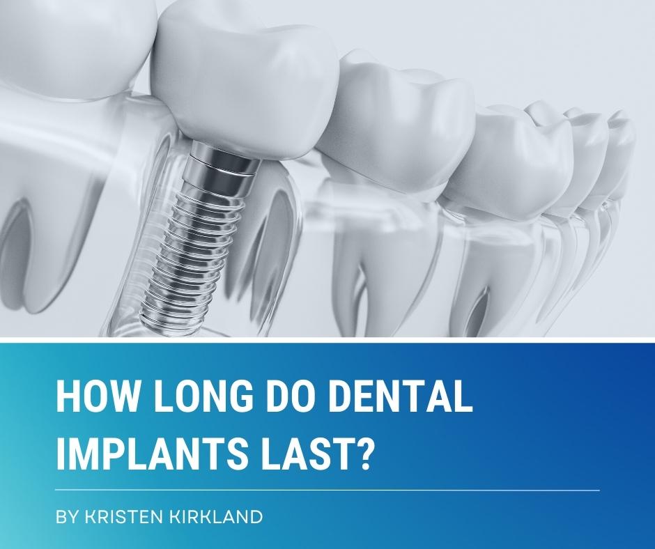 how long do dental implants last